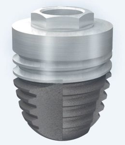 Figura 2. Implante Ticare Osseous PS de 5 x 6mm. El aumento del diámetro compensa la disminución de la longitud.