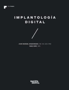 Implantología digital