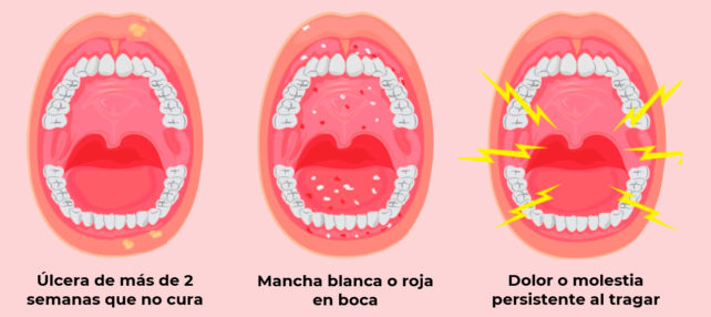 Estos son los 3 síntomas principales del cáncer oral