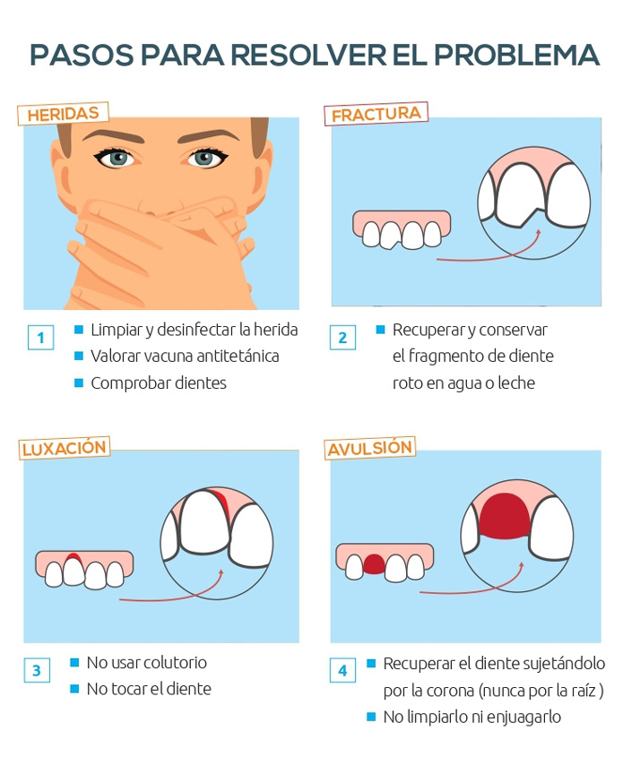 Infografía sobre qué hacer si se te rompe un diente