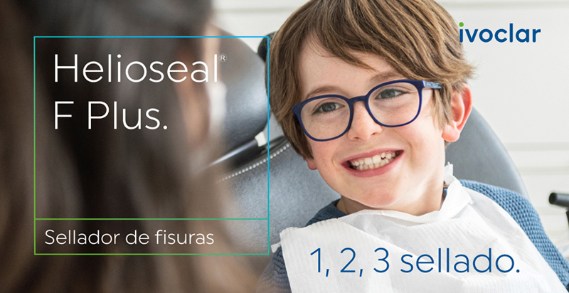Helioseal F Plus, el nuevo sellador de fisuras de Ivoclar para tus tratamientos preventivos