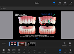Dentalplay es la única empresa que cuenta con vídeos dentales 3D en calidad 4K. 
