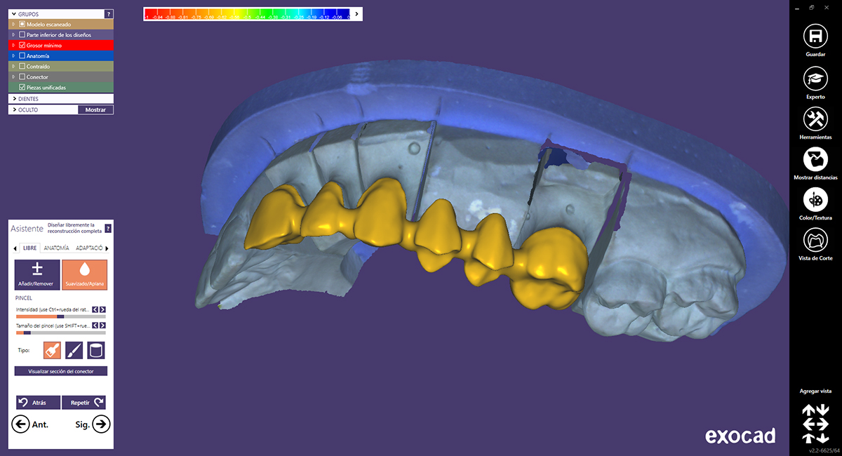 hueco Marquesina Para construir La fascinación de los sistemas CAD-CAM dentales, materiales y protocolos de  trabajo - Gaceta Dental