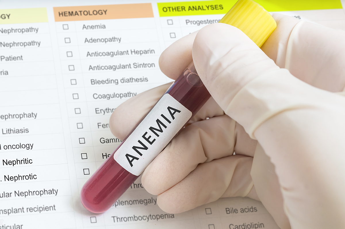 La anemia aumenta el riesgo de infecciones bucales - Gaceta Dental