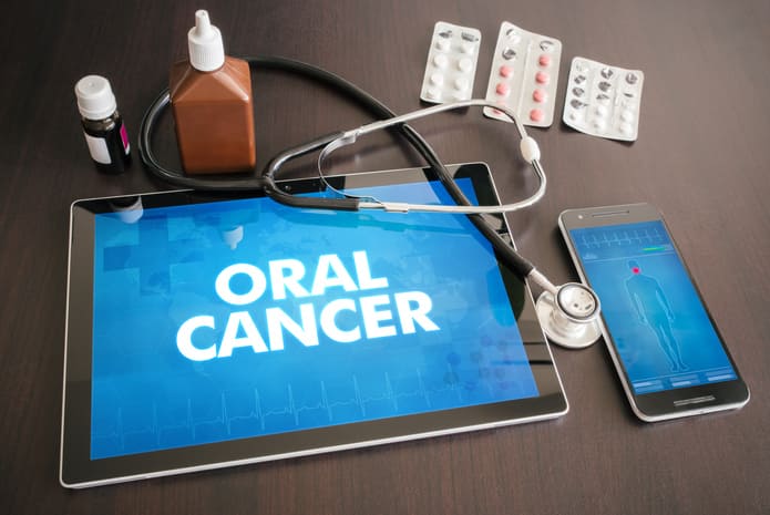 Todo sobre el cáncer oral: causas, síntomas, prevención.