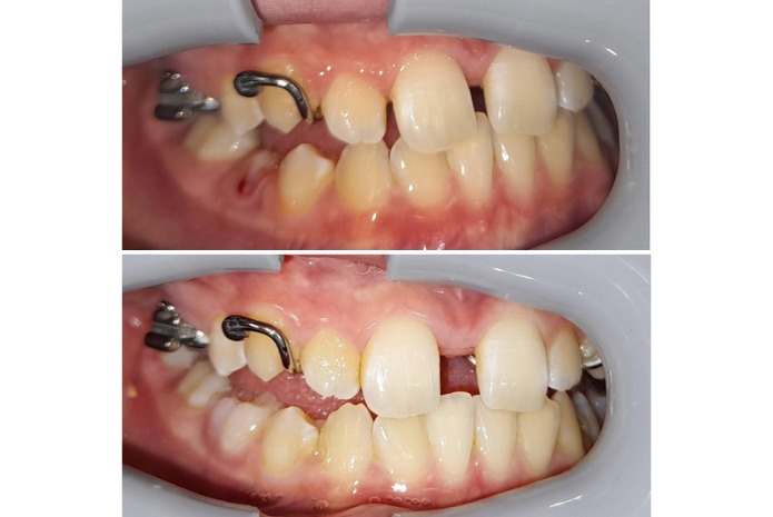 DentalMonitoring, atención médica domiciliaria en el ámbito de la Odontología