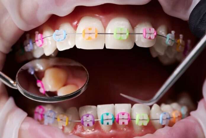 El auge de la ortodoncia