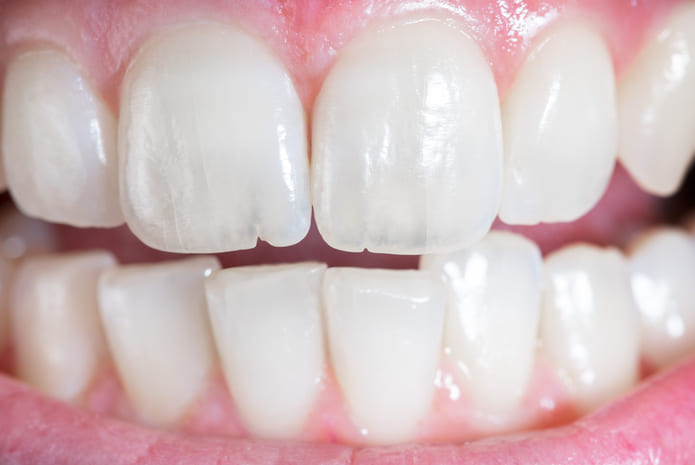 Entender la resistencia de los dientes no solo ayuda a mejorar la Odontología