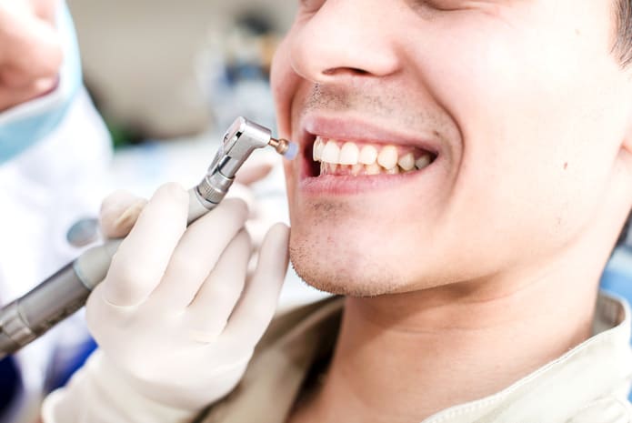 ¿Sabes qué es una limpieza dental y cómo se realiza?