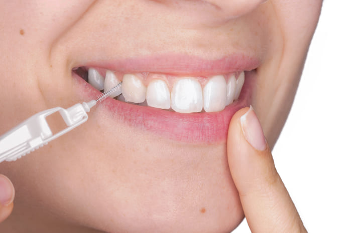 El 64% de los españoles no realiza una limpieza diaria entre los dientes