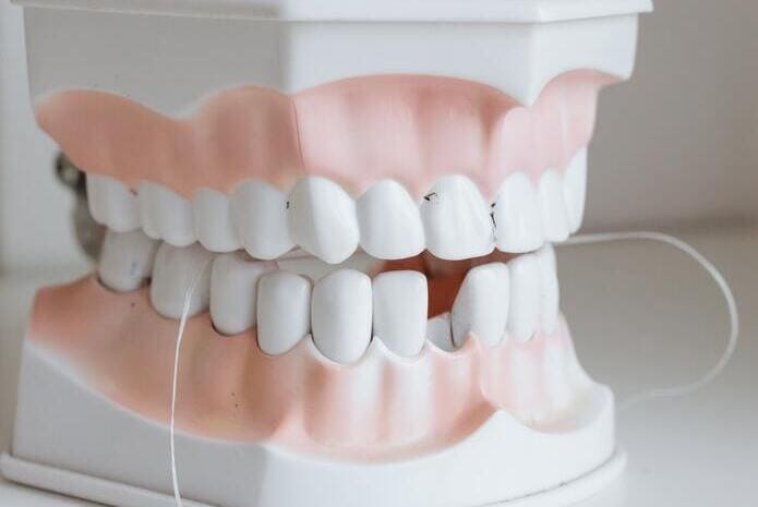 Los dentistas de la provincia tinerfeña recomiendan extremar la higiene de las prótesis dentales en verano
