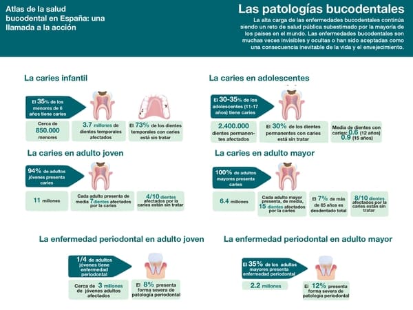 Patologías bucodentales, datos de España