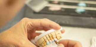Los puntos clave que debes conocer sobre la agenesia dental.