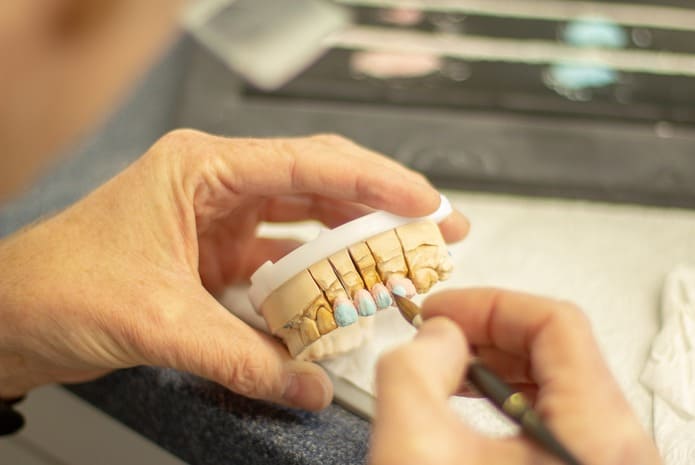 Los puntos clave que debes conocer sobre la agenesia dental.