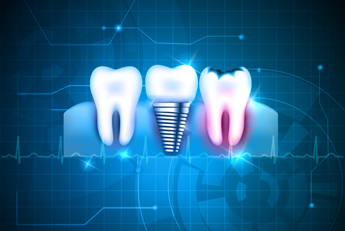 Estos 6 hitos tecnológicos marcan los puntos de inflexión del sector dental en los últimos 100 años.