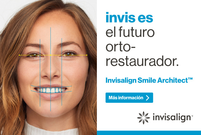 Invisalign Smile Architect™, el software del futuro para la planificación del tratamiento orto-restaurador