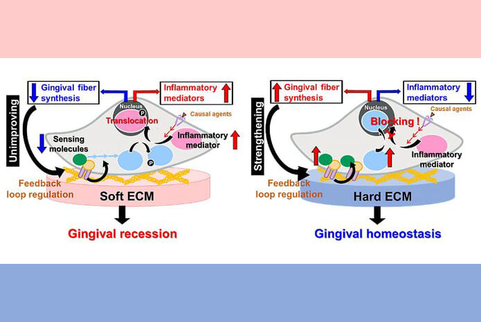 Posibles mecanismos celulares subyacentes a las respuestas proinflamatorias de los fibroblastos gingivales humanos mediadas por la rigidez del sustrato.