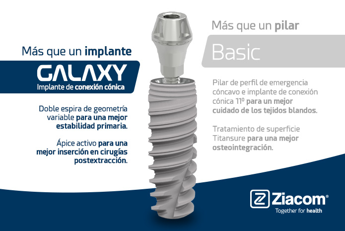 Mejora tu trabajo y la satisfacción de tus pacientes con el implante Galaxy de Ziacom