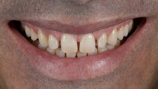Figura 8. Sonrisa tras el tratamiento de ortodoncia