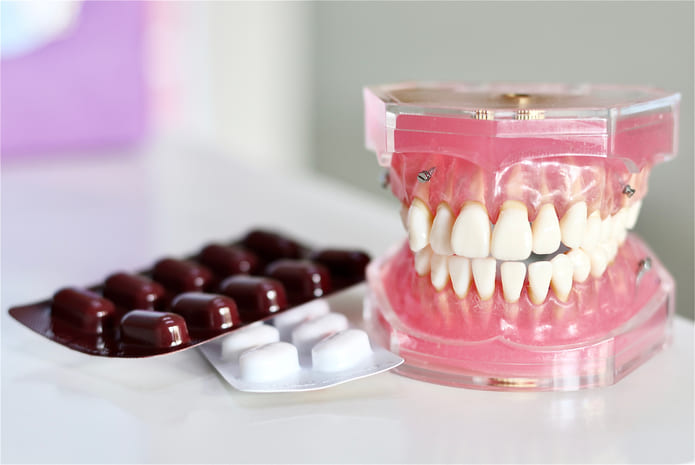 Una investigación busca proporcionar un método alternativo de administración de antibióticos para tratar la periodontitis agresiva.