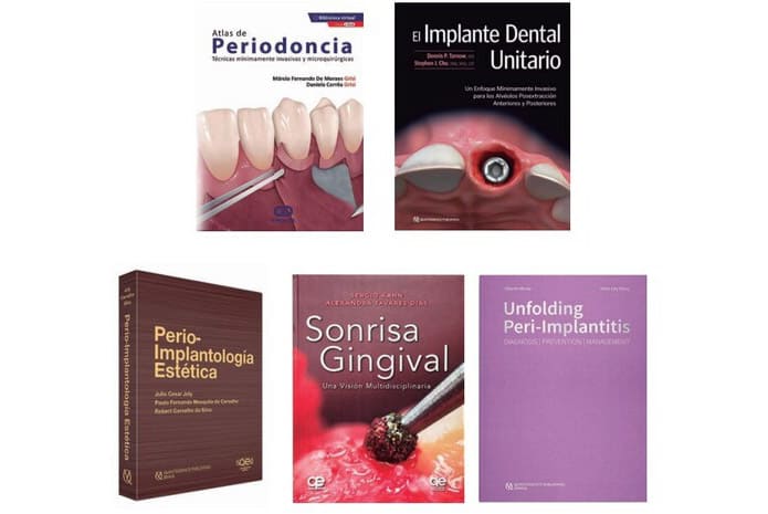 Los 5 mejores libros de Periodoncia de la Tienda Gaceta Dental
